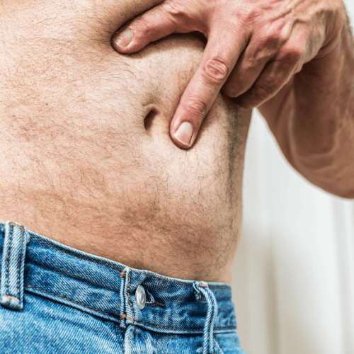 irugia-de-hernia-en-tijuana-bc-precio