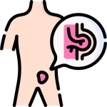 consulta-cirugia-de-hernia-en-tijuana